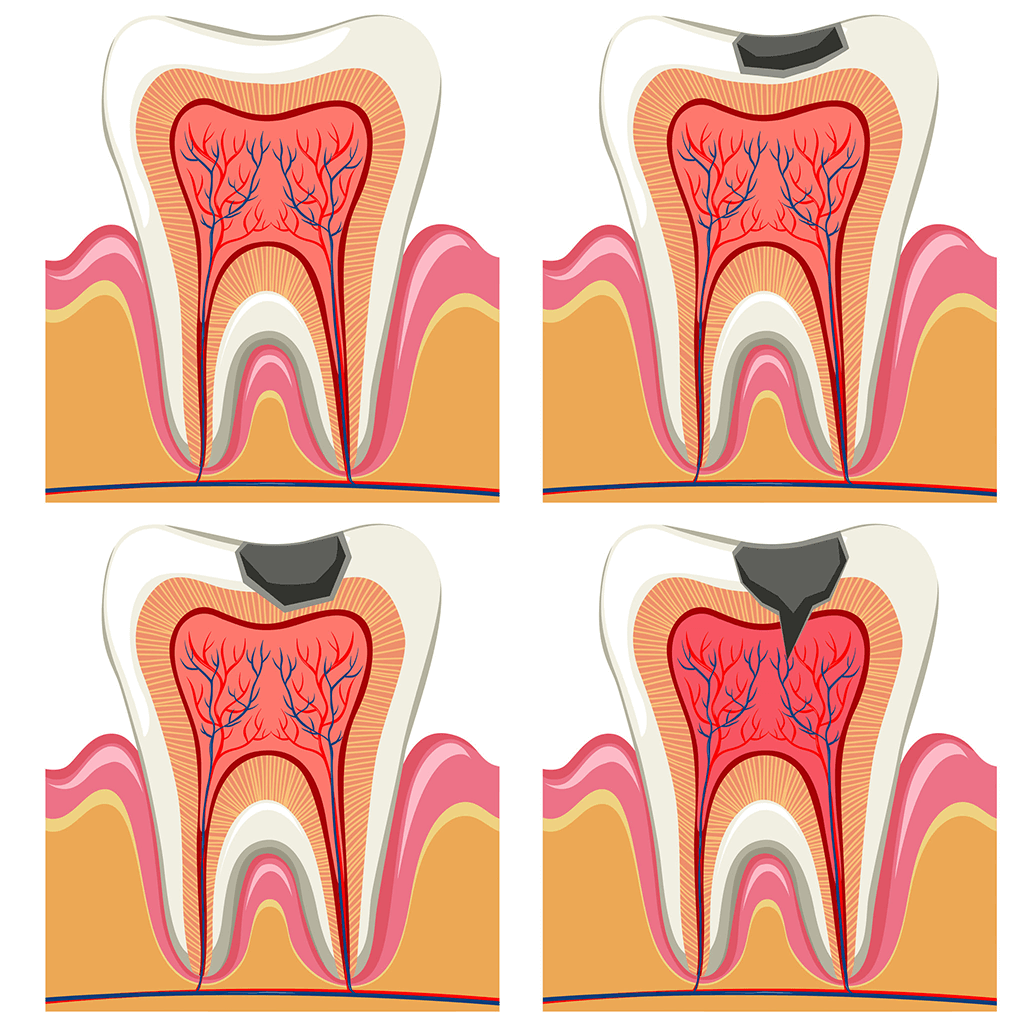 odontologia-conservadora-endodoncia