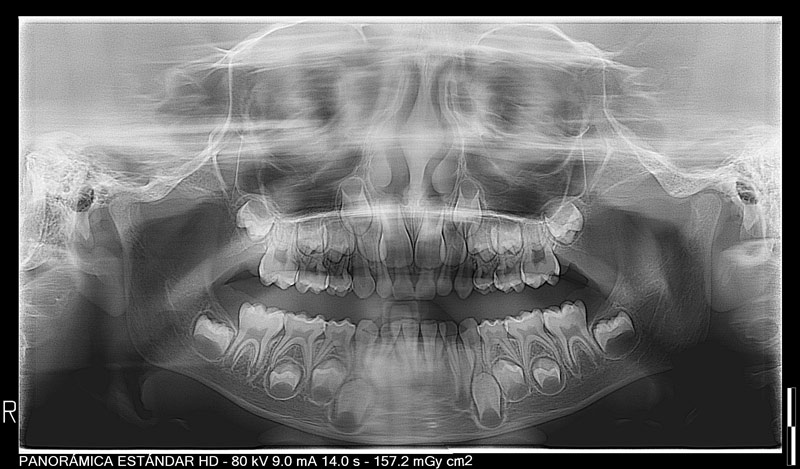 cirugia-oral-caninos-tratamientos
