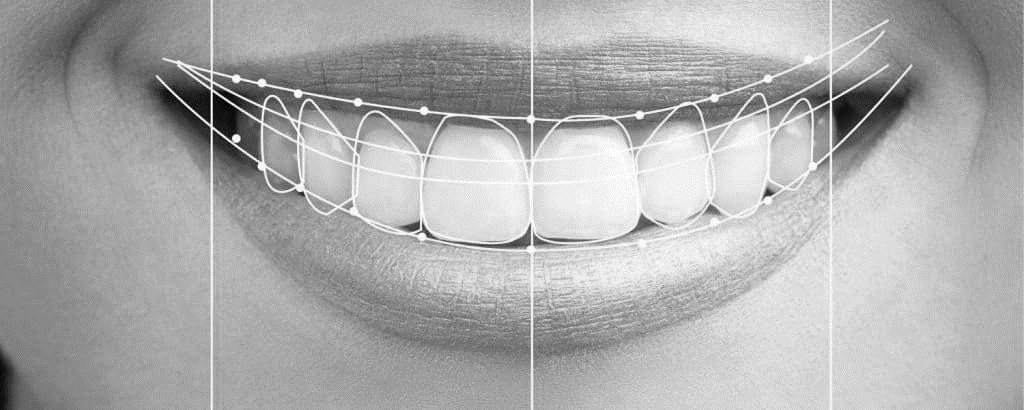 estetica-dental-diseño-sonrisa-clinica-vermont