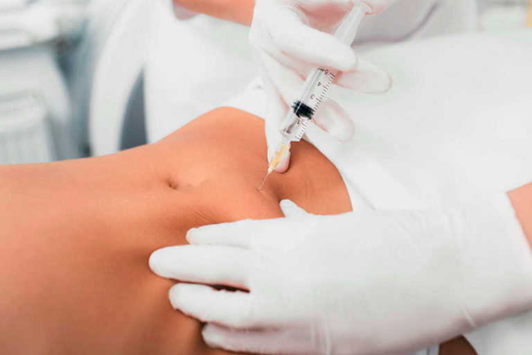 medicina-estetica-tratamiento-mesoterapia-corporal