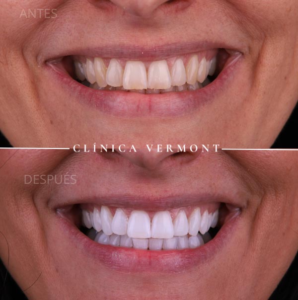 clinica dental diseño sonrisa innovacion chamartin