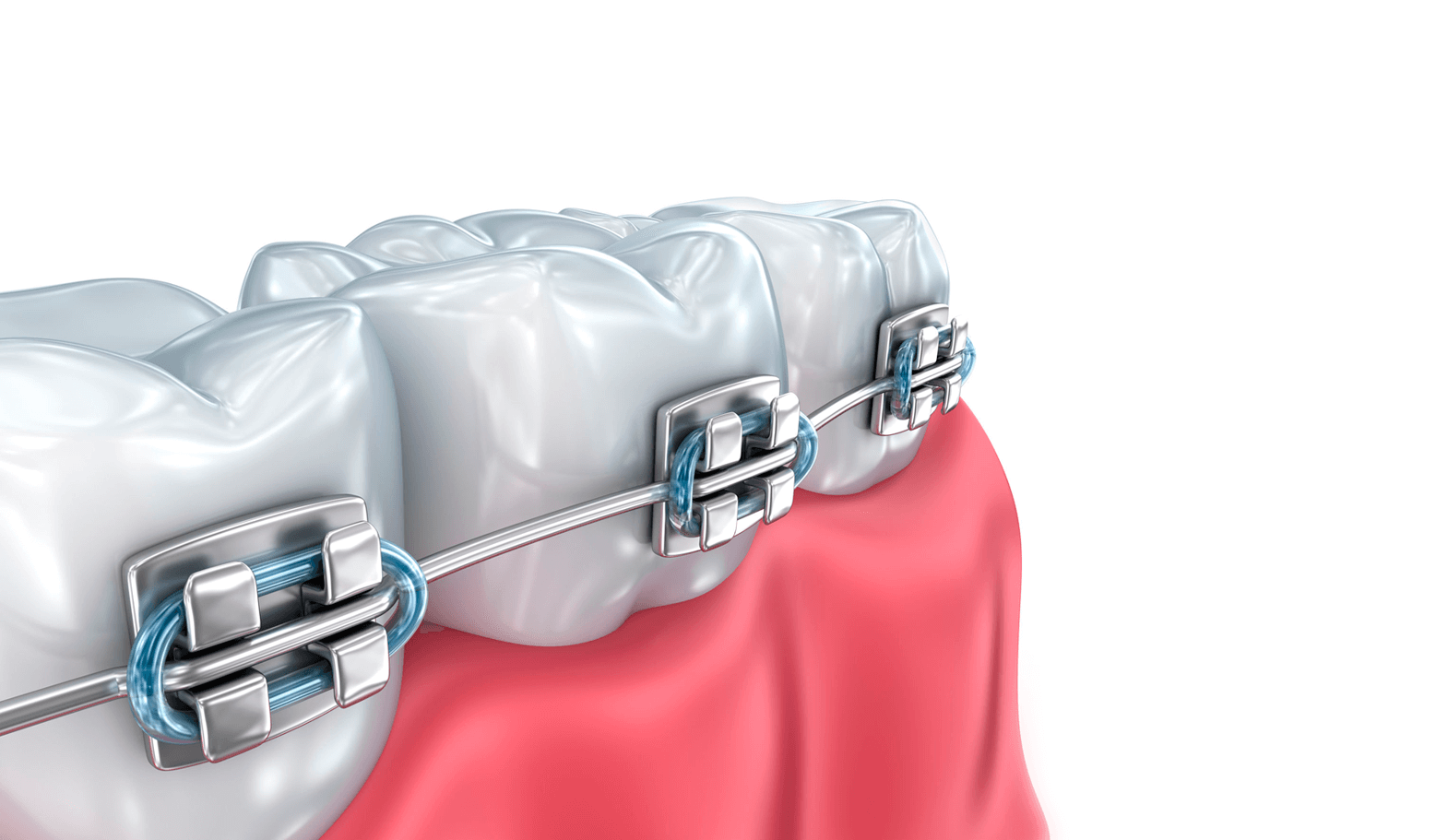 Estetica Dental Madrid