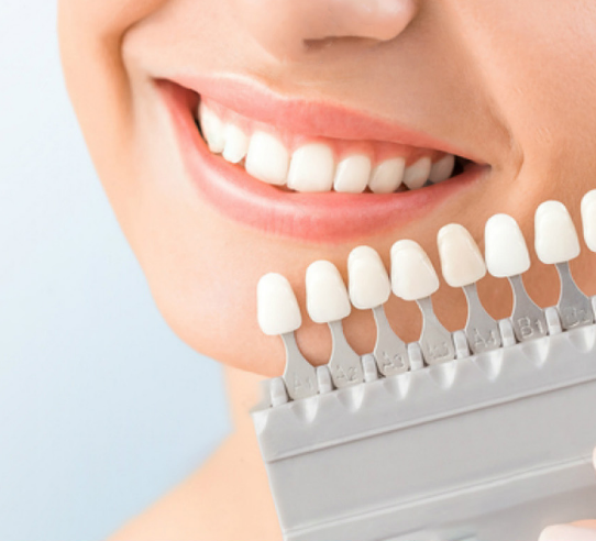 En que consiste blanqueamiento Dental
